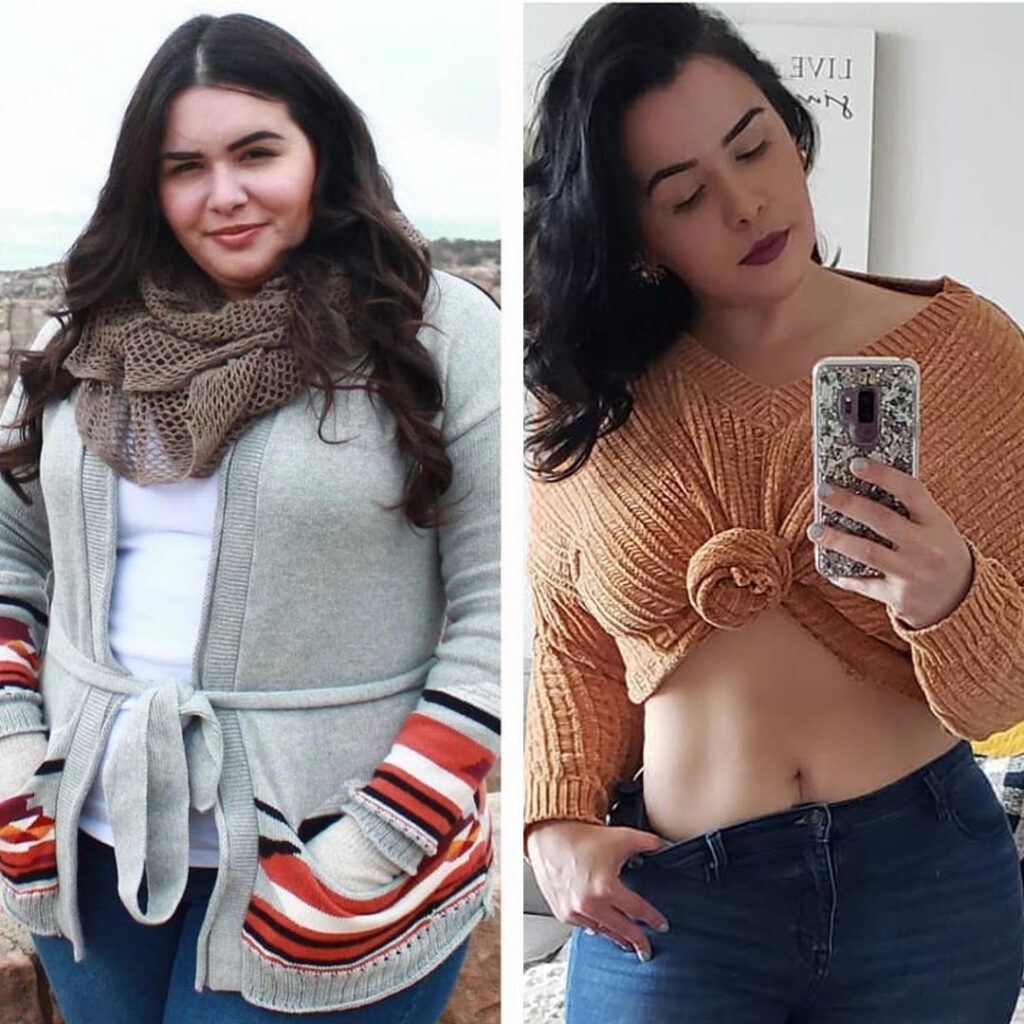 Orlistat Antes e Depois Fotos